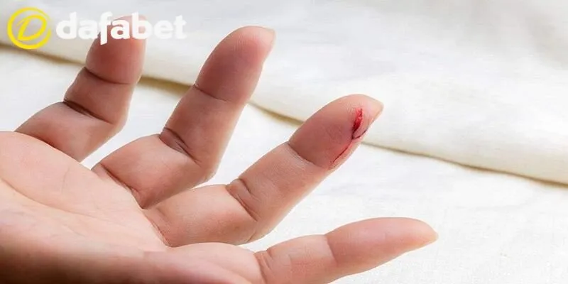 Mơ thấy máu đánh con gì để thử vận may tại Dafabet