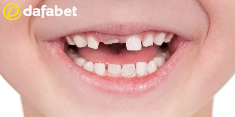 Hầu như giấc mơ về răng rụng đều có một điềm báo không được may mắn